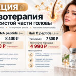 Мезотерапия волосистой части головы — специальные цены на Hair X